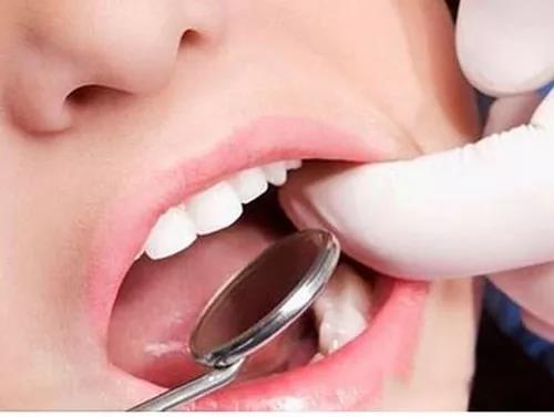 医生补牙为什么用树脂充填？树脂可以使用多长时间？